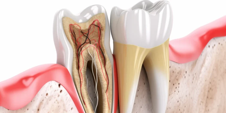 Jak często do dentysty?