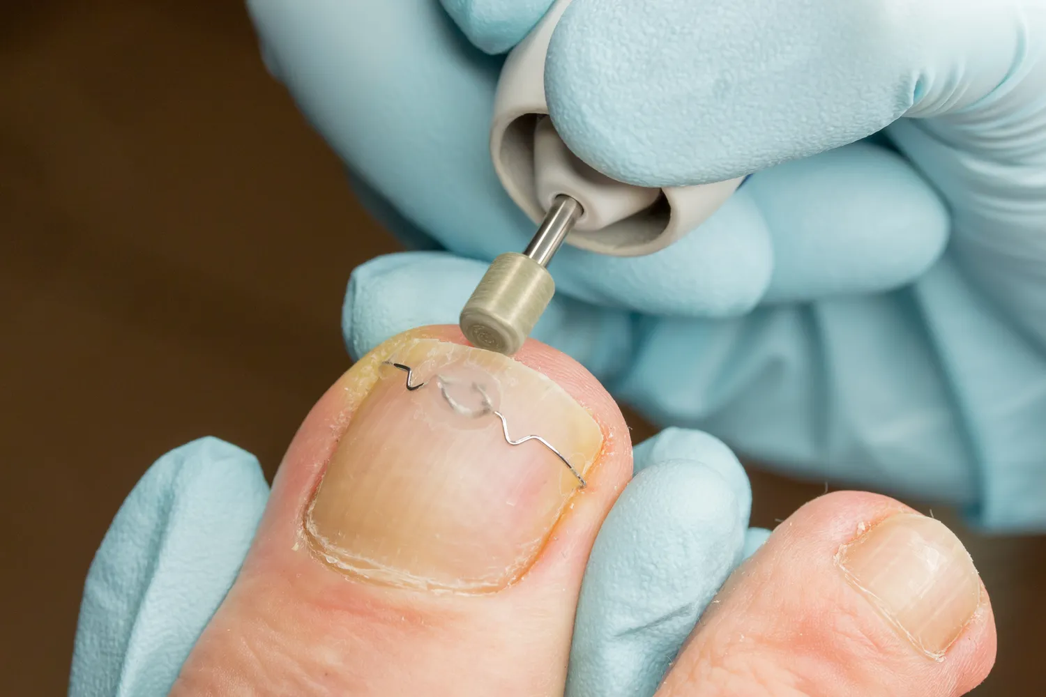 Podologia - medycyna czy kosmetyka?